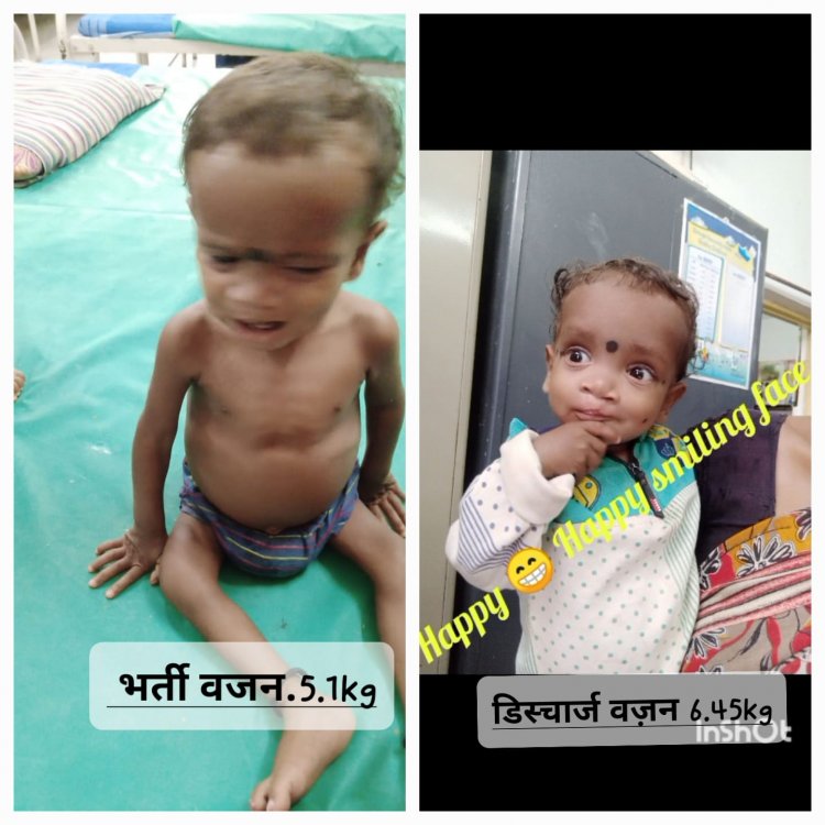 सेवा की कहानी : पोषण पुनर्वास केंद्र ने ओमेश को कुपोषण से उबारा, अब स्वस्थ होकर लौटा घर